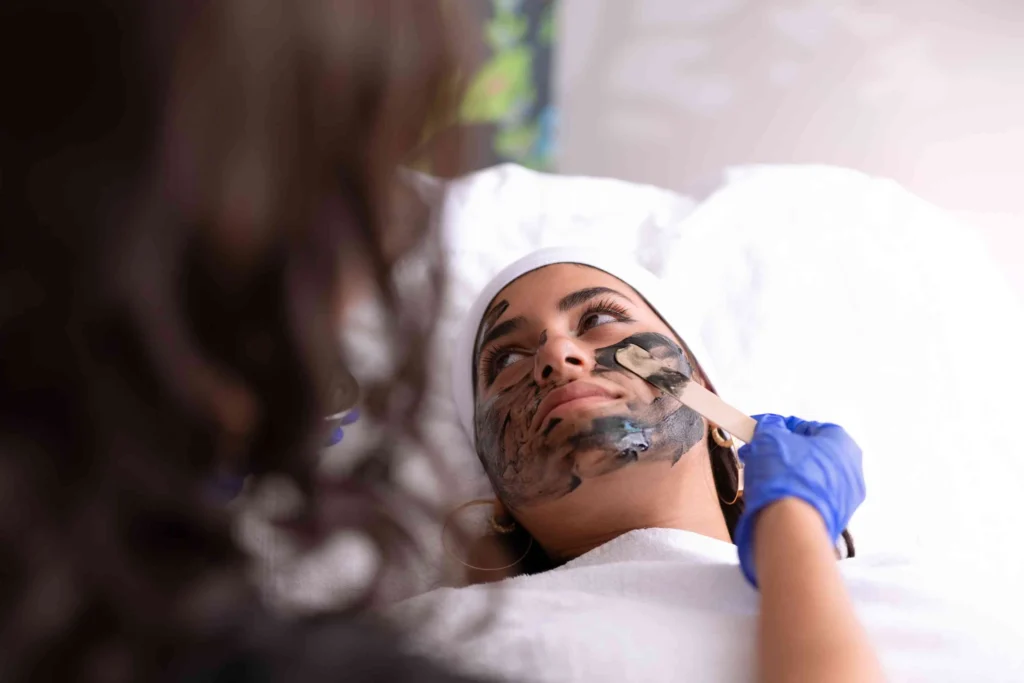 Chemical Peels