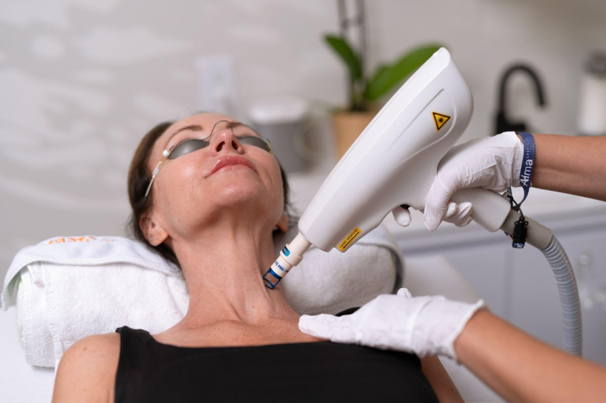 Photofacial & Photobody (IPL)