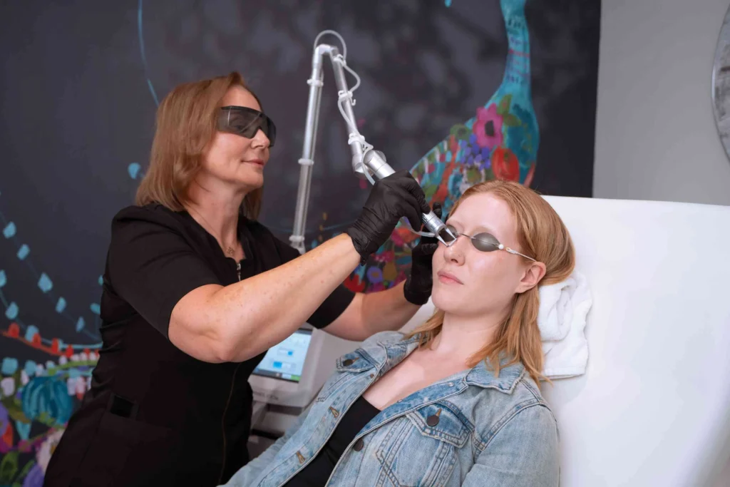 CO2 Laser Resurfacing treatment