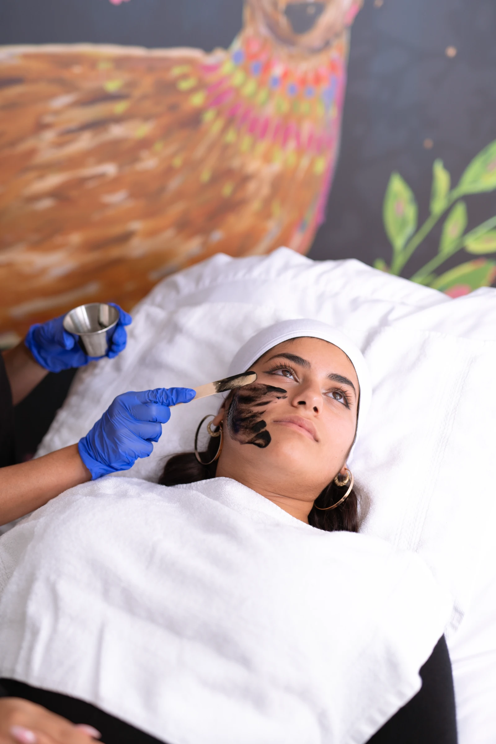 Chemical Peels treatment