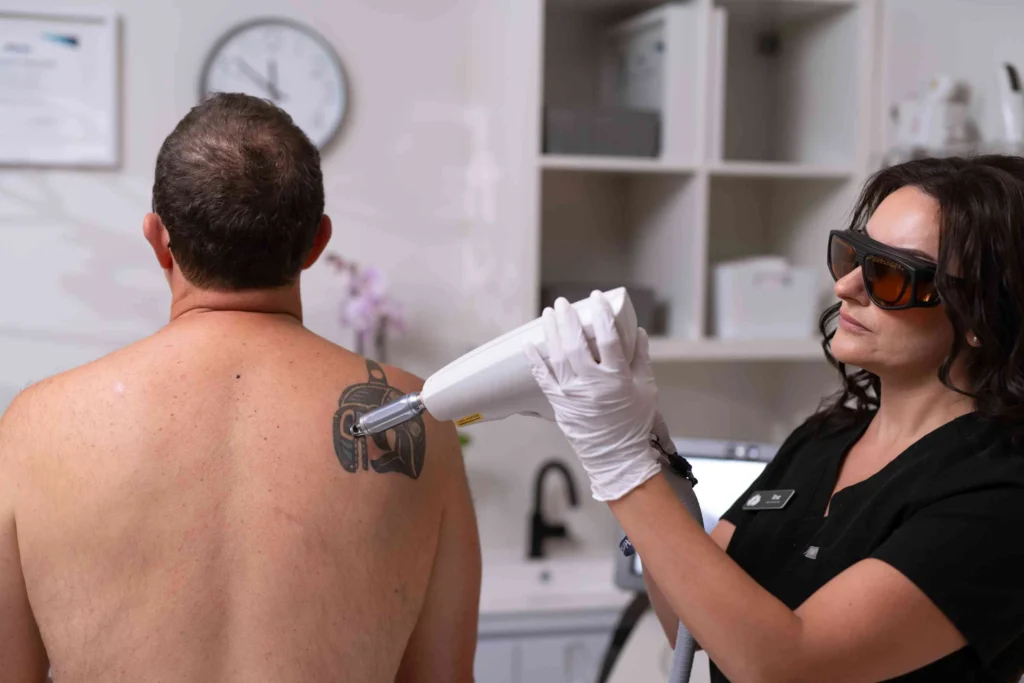 Laser Tattoo Reduction